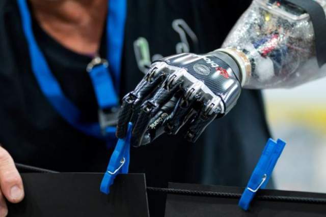 Motorised arm prostheses.jpeg
